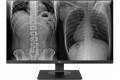 LG 27" 27HJ713C-B Clinical Review Monitor