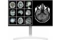 LG 27 Inch 3840 x 2160 Pixels 4K Ultra HD Medical Computer Monitor